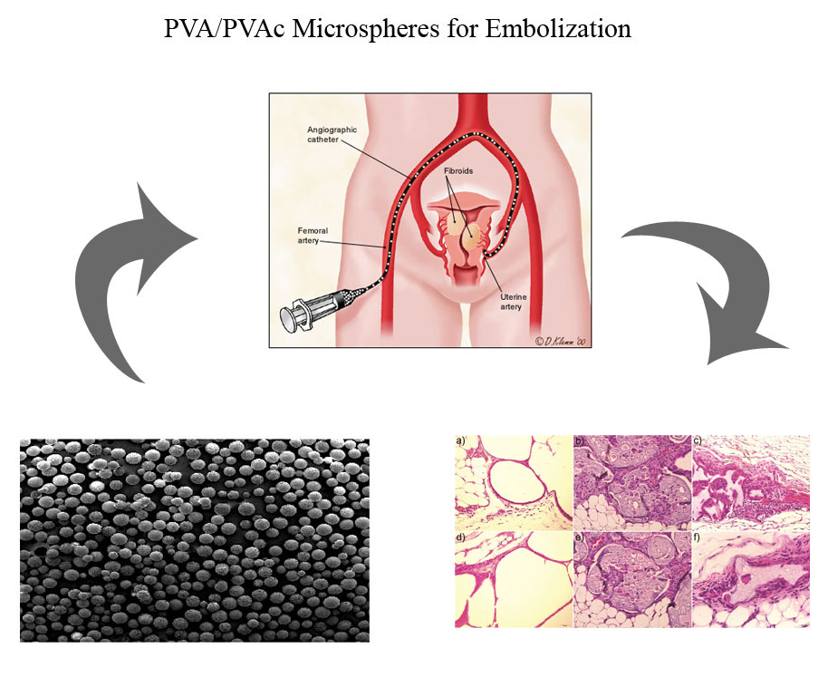 Synthesis of Inorganic and Polimeric Microspheres for treatment of Neoplasia Through Chemioembolization